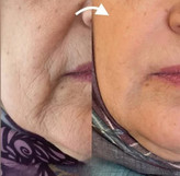 کرم لیفتینگ پوست ۱۲۰ میل لاکچری کوین